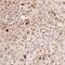 BRCA1 Interacting Protein C-Terminal Helicase 1 antibody, MAB6496, R&D Systems, Immunohistochemistry paraffin image 