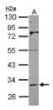 NAD-dependent deacetylase sirtuin-3, mitochondrial antibody, NBP2-20371, Novus Biologicals, Western Blot image 