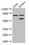 Prolyl 3-hydroxylase 2 antibody, LS-C678923, Lifespan Biosciences, Western Blot image 