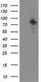 Protein Kinase C Epsilon antibody, TA502367S, Origene, Western Blot image 