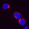 C-X-C Motif Chemokine Ligand 8 antibody, AF2277, R&D Systems, Immunofluorescence image 