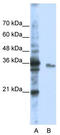Exosome complex exonuclease RRP40 antibody, TA345700, Origene, Western Blot image 