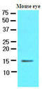 Cellular retinoic acid-binding protein 1 antibody, AM09092PU-S, Origene, Western Blot image 