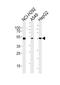 Aldehyde dehydrogenase, mitochondrial antibody, M00546-4, Boster Biological Technology, Western Blot image 