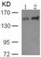 Phospholipase C Gamma 1 antibody, TA322973, Origene, Western Blot image 