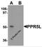 Proline Rich 5 Like antibody, 6293, ProSci, Western Blot image 