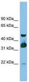 MTOR Associated Protein, LST8 Homolog antibody, TA344683, Origene, Western Blot image 