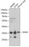SPARC antibody, GTX55805, GeneTex, Western Blot image 
