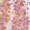Protein Tyrosine Kinase 2 antibody, LS-C352764, Lifespan Biosciences, Immunohistochemistry paraffin image 