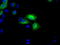 3-Hydroxybutyrate Dehydrogenase 2 antibody, TA501291, Origene, Immunofluorescence image 