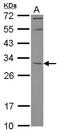 Potassium Channel Tetramerization Domain Containing 4 antibody, GTX118894, GeneTex, Western Blot image 