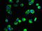 Glycoprotein M6A antibody, LS-C375821, Lifespan Biosciences, Immunofluorescence image 