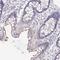 Protein Tyrosine Phosphatase Non-Receptor Type 14 antibody, HPA053864, Atlas Antibodies, Immunohistochemistry frozen image 
