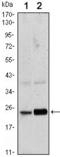 RAB10, Member RAS Oncogene Family antibody, GTX82800, GeneTex, Western Blot image 