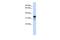 Regulator Of Microtubule Dynamics 1 antibody, PA5-42837, Invitrogen Antibodies, Western Blot image 