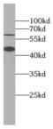 p60 antibody, FNab08823, FineTest, Western Blot image 