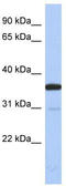 Esterase D antibody, TA344262, Origene, Western Blot image 