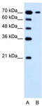 Solute Carrier Family 5 Member 4 antibody, TA333873, Origene, Western Blot image 