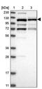 VPS50 Subunit Of EARP/GARPII Complex antibody, PA5-55374, Invitrogen Antibodies, Western Blot image 