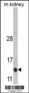 DnaJ Heat Shock Protein Family (Hsp40) Member C19 antibody, 62-312, ProSci, Western Blot image 