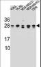 RAB16 antibody, LS-C162379, Lifespan Biosciences, Western Blot image 