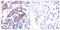 ETS Transcription Factor ELK1 antibody, GTX50092, GeneTex, Immunohistochemistry paraffin image 