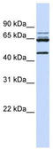 DEAD-Box Helicase 47 antibody, TA341598, Origene, Western Blot image 