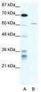 IKAROS Family Zinc Finger 4 antibody, TA331770, Origene, Western Blot image 