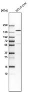 Tetratricopeptide Repeat Domain 21B antibody, HPA035495, Atlas Antibodies, Western Blot image 