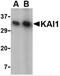 CD82 Molecule antibody, 4073, ProSci, Western Blot image 