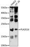 Group XVI phospholipase A2 antibody, 16-377, ProSci, Western Blot image 