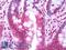 Mitogen-Activated Protein Kinase 4 antibody, LS-B10768, Lifespan Biosciences, Immunohistochemistry paraffin image 