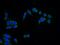 SEC61 Translocon Beta Subunit antibody, 14846-1-AP, Proteintech Group, Immunofluorescence image 