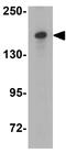 Lysine Demethylase 6B antibody, GTX31466, GeneTex, Western Blot image 