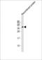 FAT Atypical Cadherin 4 antibody, MA5-24748, Invitrogen Antibodies, Western Blot image 