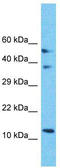 Mitochondrial Ribosomal Protein S18C antibody, TA337441, Origene, Western Blot image 