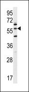 Leucine Zipper And EF-Hand Containing Transmembrane Protein 2 antibody, 56-372, ProSci, Western Blot image 