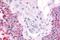 Cell division cycle 7-related protein kinase antibody, NLS7980, Novus Biologicals, Immunohistochemistry paraffin image 