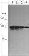 Cadherin 3 antibody, CM5961, ECM Biosciences, Western Blot image 