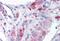 Metastasis Associated 1 antibody, GTX20751, GeneTex, Immunohistochemistry paraffin image 