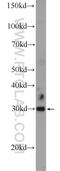NKAP Domain Containing 1 antibody, 21181-1-AP, Proteintech Group, Western Blot image 