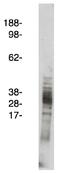 Arachidonate 5-Lipoxygenase Activating Protein antibody, AP05297SU-N, Origene, Western Blot image 