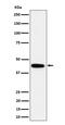 Galactose-1-Phosphate Uridylyltransferase antibody, M01460, Boster Biological Technology, Western Blot image 
