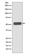 Lymphocyte-specific protein 1 antibody, M02992, Boster Biological Technology, Western Blot image 