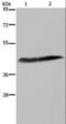 Colony Stimulating Factor 2 Receptor Alpha Subunit antibody, LS-C405628, Lifespan Biosciences, Western Blot image 