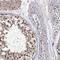 Ring Finger Protein 44 antibody, HPA038981, Atlas Antibodies, Immunohistochemistry frozen image 