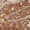 Cerebellar Degeneration Related Protein 2 antibody, FNab01568, FineTest, Immunohistochemistry paraffin image 