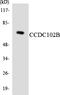 Coiled-Coil Domain Containing 102B antibody, LS-C291757, Lifespan Biosciences, Western Blot image 