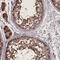 Cytosolic Iron-Sulfur Assembly Component 2B antibody, HPA041736, Atlas Antibodies, Immunohistochemistry paraffin image 