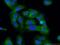 Sushi Repeat Containing Protein X-Linked 2 antibody, 66266-1-Ig, Proteintech Group, Immunofluorescence image 